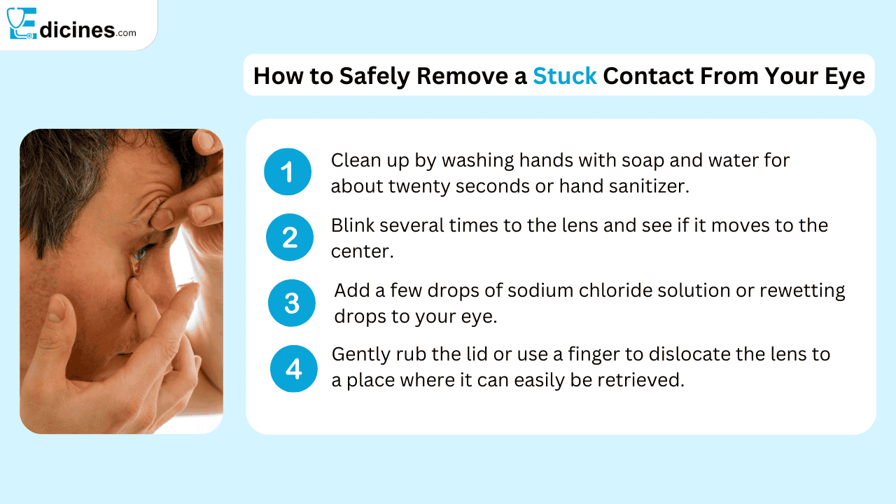 How to Safely Remove a Stuck Contact From Your Eye
